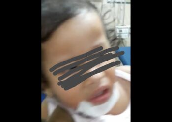 Akibat Jalan Berlubang Di Aceh Singkil, Pengendara Jatuh Membawa Balita