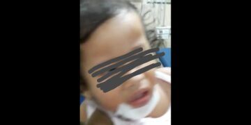 Akibat Jalan Berlubang Di Aceh Singkil, Pengendara Jatuh Membawa Balita