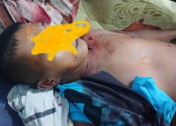 Hendak Mencari Tripang Satu Warga Diterkam Buaya