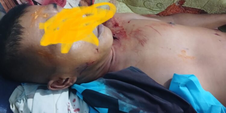 Hendak Mencari Tripang Satu Warga Diterkam Buaya