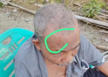 Lansia Disabilitas Dianiaya Tetangga di Aceh Singkil, Keluarga Pertanyakan Lambannya Proses Hukum