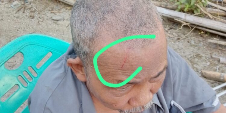 Lansia Disabilitas Dianiaya Tetangga di Aceh Singkil, Keluarga Pertanyakan Lambannya Proses Hukum