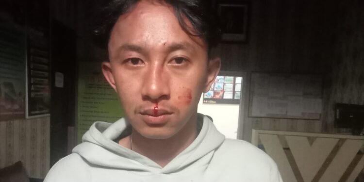 Niat Melerai Berujung Luka, Pemuda Asal Tasikmalaya Dianiaya OTK di Lapangan Beringin Subulussalam